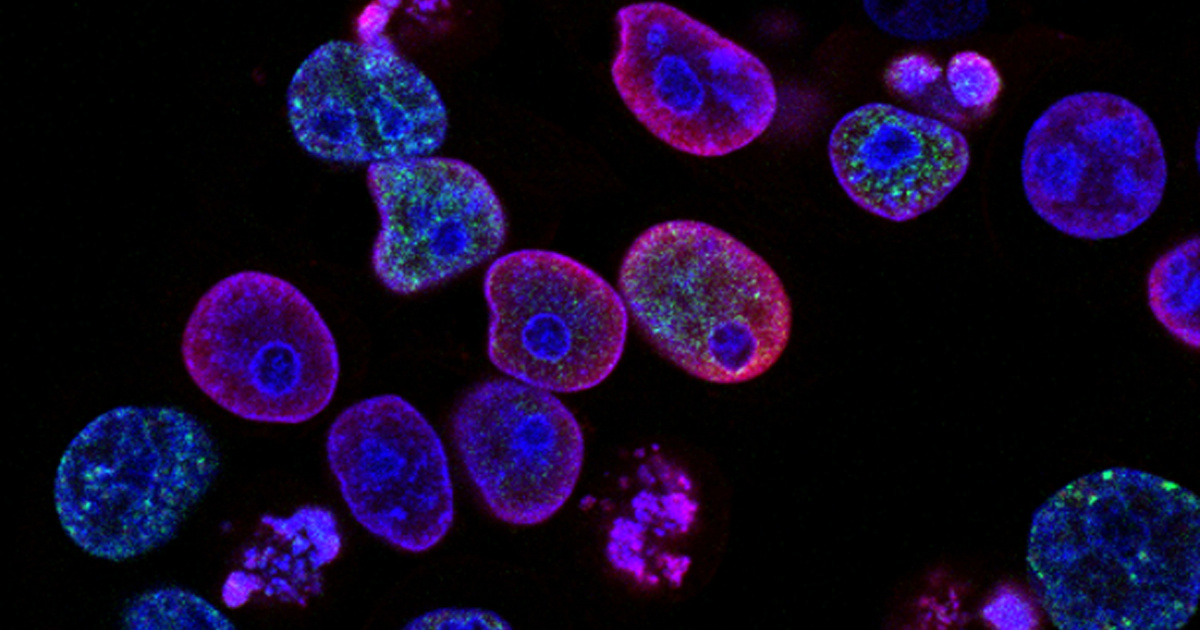 Medicina Personalizzata In Ambito Oncologico Selezionato Dal Ministero 
